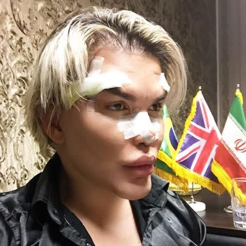 Rodrigo's latest procedure saw him undergo a cat eye lift. Photo: Instagram