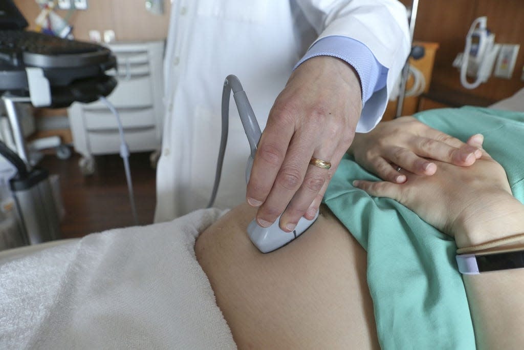 FILE - In this Aug. 7, 2018 file photo, a doctor performs an ultrasound scan on a pregnant woman at a hospital in Chicago.  (AP Photo/Teresa Crawford, File)