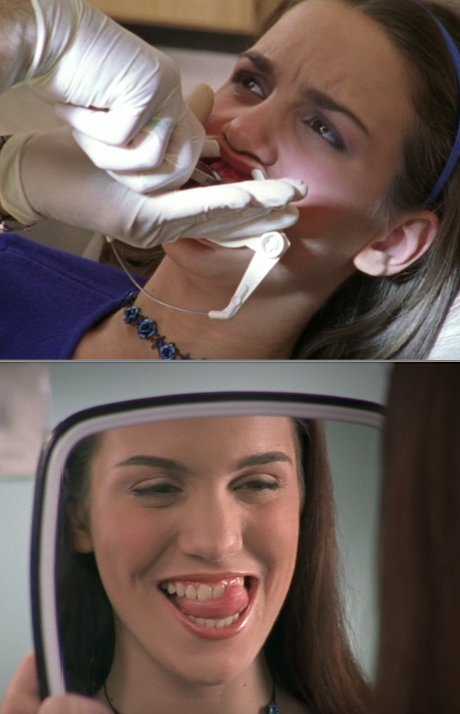 Ren getting her braces off in "Even Stevens"