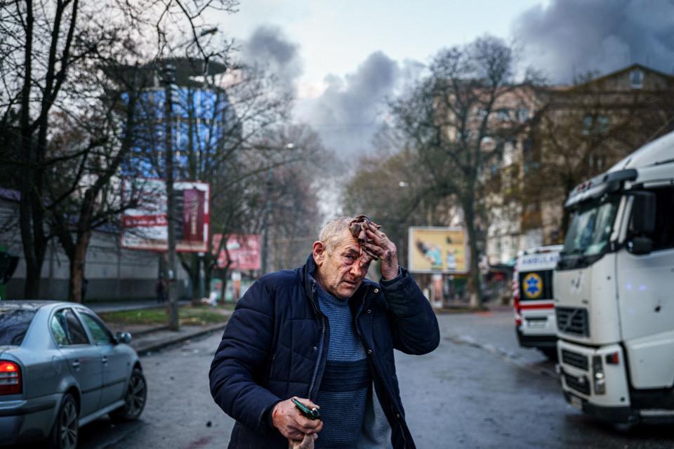 December 24, 2022: An injured man stands on a street after Russian shelling of the Ukrainian city of Kherson, where five were killed and 20 injured. - Ukrainian President Volodymyr Zelensky blasted Russian "terror" after shelling left at least five dead and 20 injured in Kherson city, which Kyiv's forces recaptured in November.