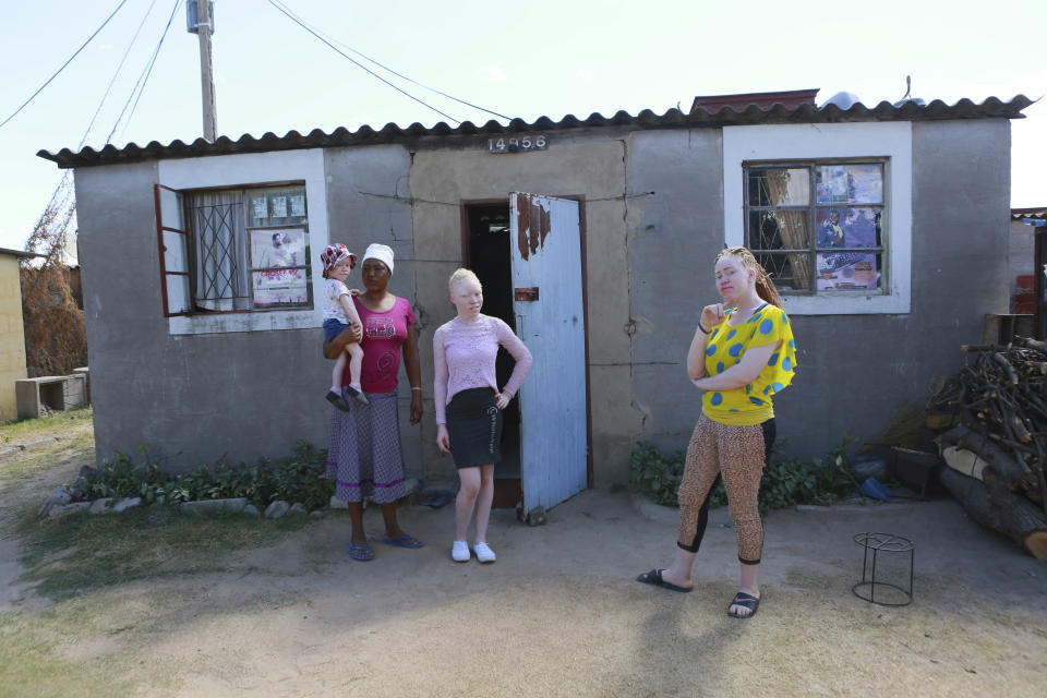 Joyce Muchenje, left, poses for a photo with her three children, who all have albinism ,outside their family home in Chitungwiza on the outskirts of Harare, in this Tuesday, June, 9, 2020 photo. Muchenje used to provide for them by washing laundry and household cleaning for cross border traders at a busy border town before the lockdown, but now the border trade has stopped and Mutenje has run out of money to get the skin cream for her children.(AP Photo/Tsvangirayi Mukwazhi)