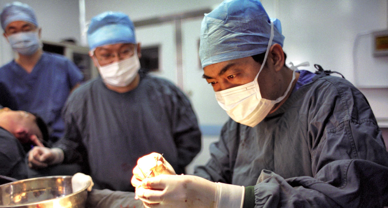 Face transplant surgery has been performed 40 times worldwide. (Photo: Getty Images)