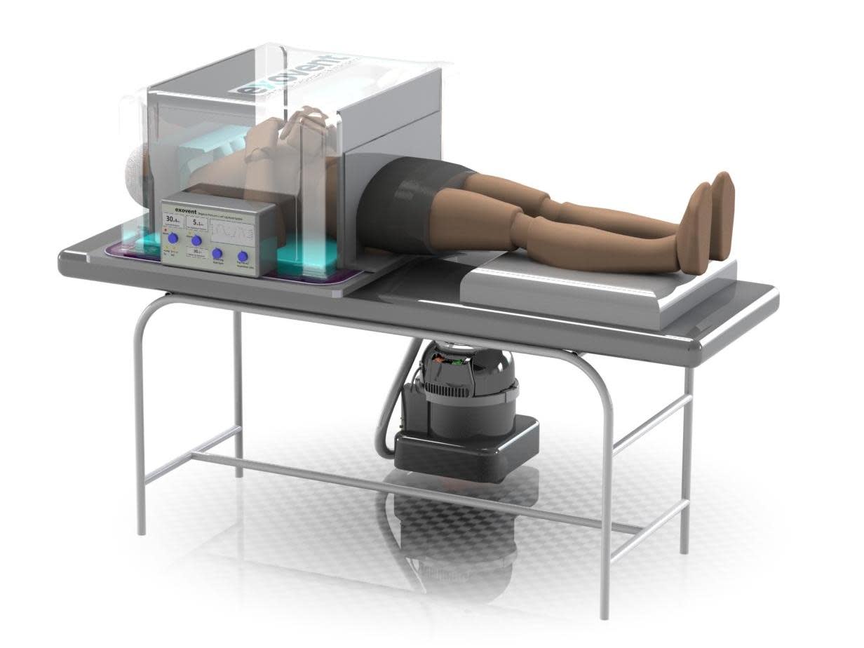 A computer generated image of the newly-invented exovent ventilator developed by a group of scientists and doctors: Exovent