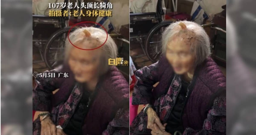 大陸廣東省一名107歲老婦，被拍到頭頂長著犄角。（圖／翻攝自微博、抖音）