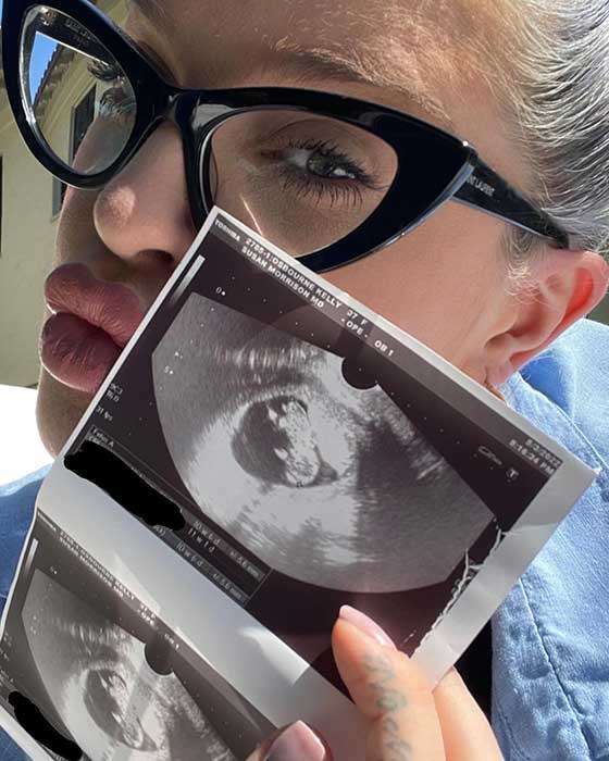 kelly-osbourne-ultrasound