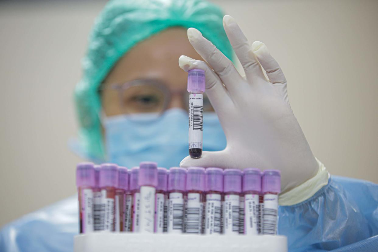 Health worker taken blood sample from medical personnel using the COVID-19 serology test method at Siloam Hospital, in Jakarta, Indonesia on August 11, 2020. (Photo: Jefta Images/Barcroft Media via Getty Images)