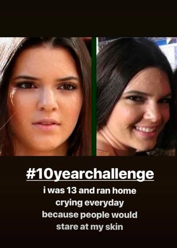 Photo credit: Instagram @KendallJenner