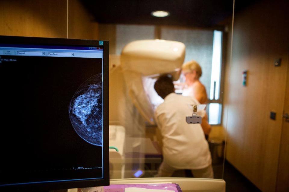 PHOTO: In this Nov 30, 2016, file photo, a technician carries out a routine mammogram. (UIG via Getty Images, FILE)
