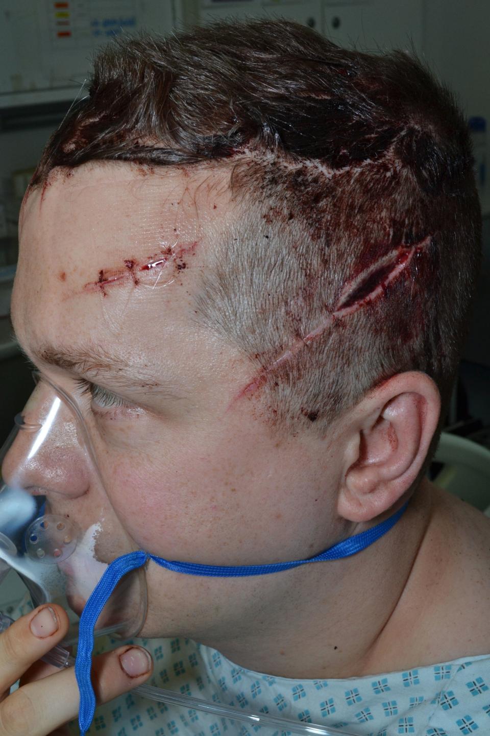 The officer suffered deep gashes to his head as well as broken fingers and a wound to the arm (PA)