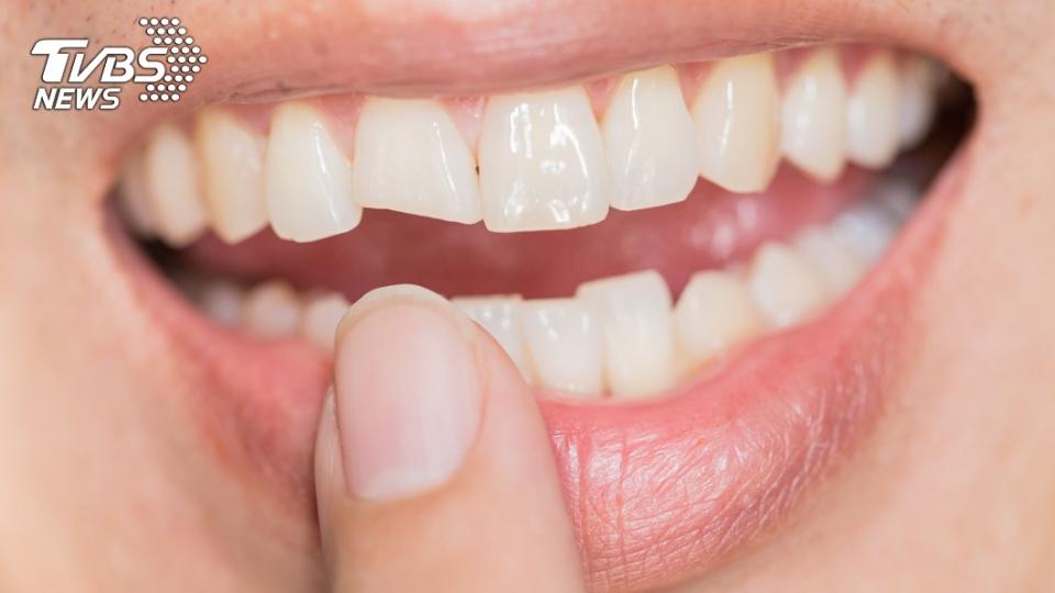 牙醫師建議，飯後半小時再刷牙為佳，如此一來口中的酸性會隨著時間中和掉，減少對琺瑯質的傷害。示意圖／TVBS