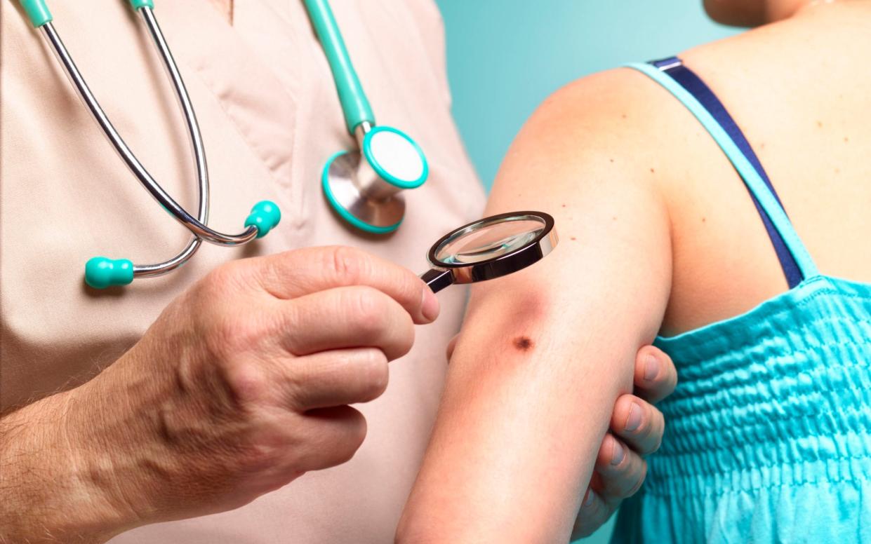 Doctor examining woman with melanoma - Peter Dazeley/The Image Bank