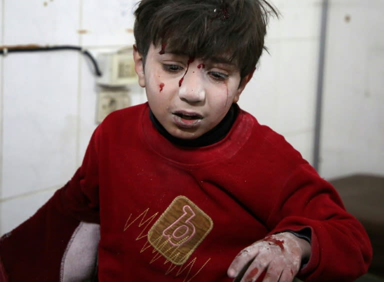 A wounded Syrian boy waits for treatment a make-shift hospital in Kafr Batna following government bombing of the besieged Eastern Ghouta region outside Damascus on February 21, 2018