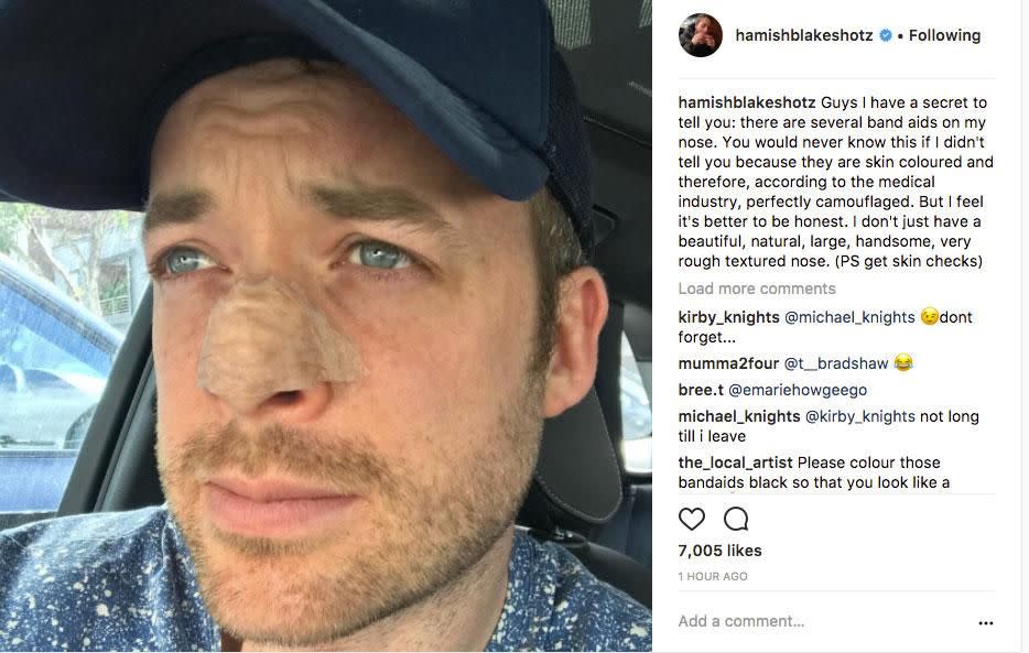 Australian radio host Hamish Blake is encouraging fans to get regular checkups, after his own skin cancer care. Source: Instagram