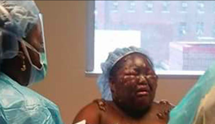 Jamoneisha Merritt is now recovering from her scalding in a “hot water challenge.” (Photo: Facebook)