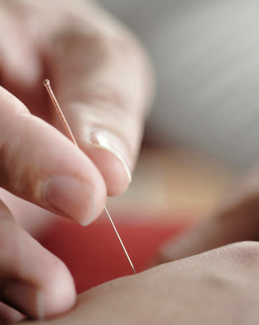 Acupuncture is used to free any blockages so qi can flow better. Contrary to some beliefs, the needles are so fine they can hardly be felt at all. There are over 800 acupoints, each corresponding to a particular part of the body or health problem.