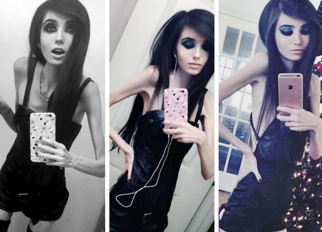 Thousands sign petition to ban worryingly thin vlogger Eugenia Cooney from   - Yahoo Sport