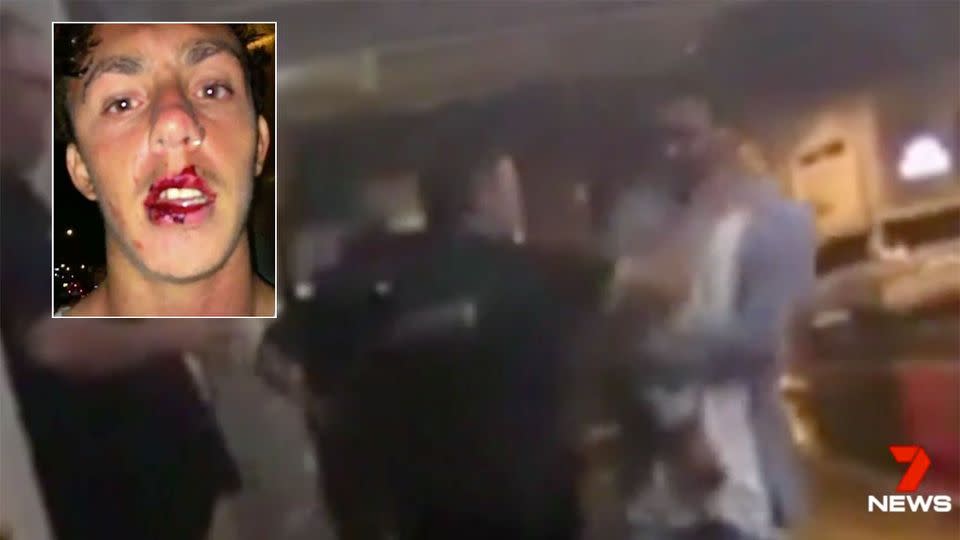 Josh was punched and choked by security outside a Coffs Harbour pub on St Patrick's Day. Source: 7 News