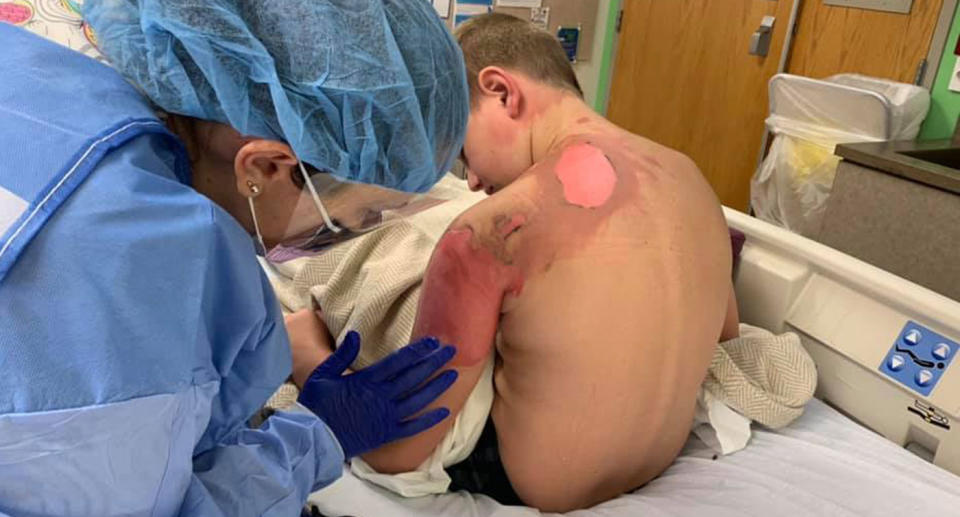 Billy Oliver is checked over by doctors after he was scalded with hot water. The 11-year-old received second and third degree burns after his mum said he took part in the hot water challenge.