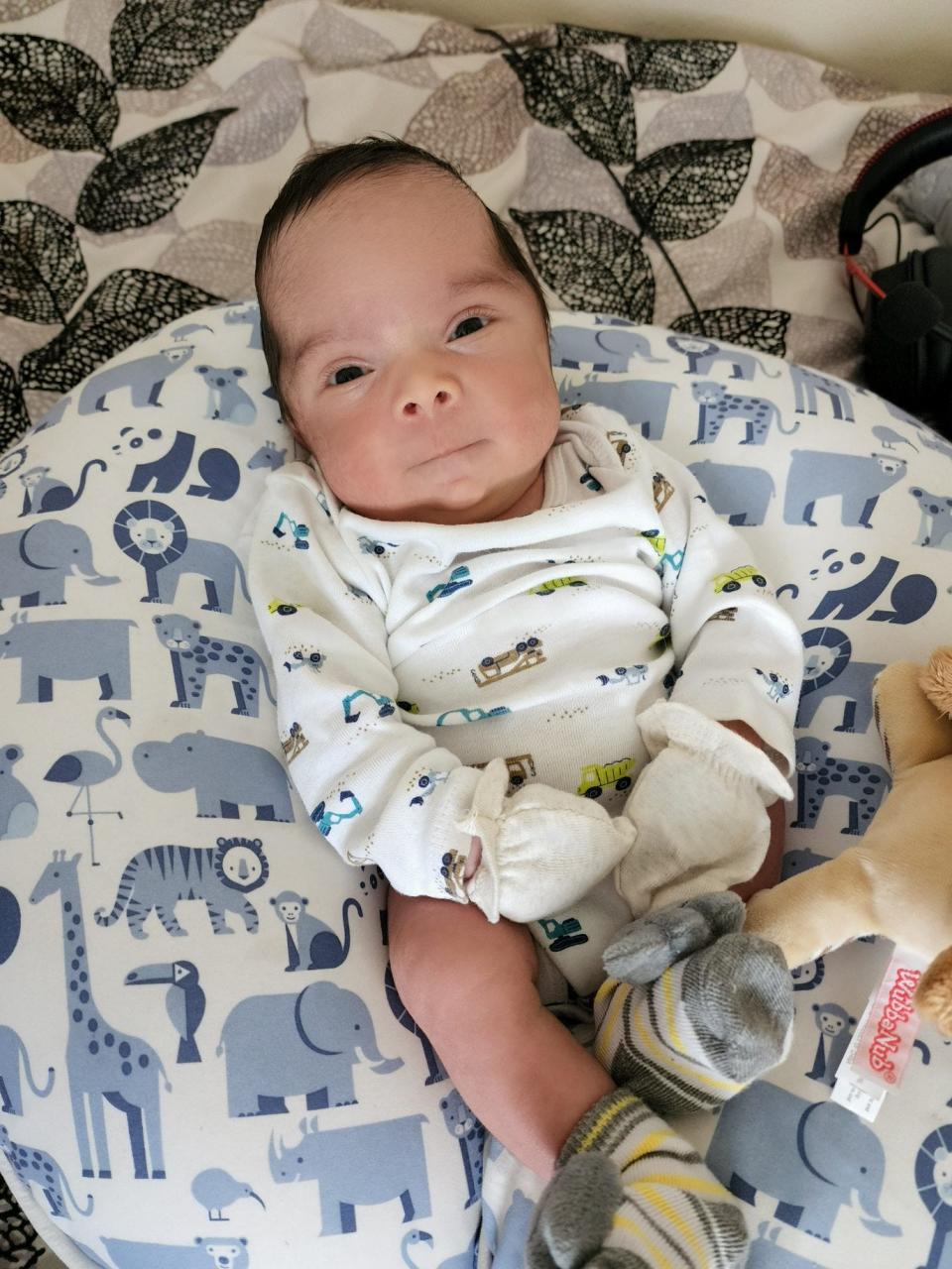 Ares Sanchez is celebrating his first Mother's Day with his mother, Edith Sanchez, after his birth and a fetoscopic procedure to repair his spina bifida in utero.
