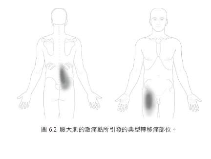 腰大肌的激痛點所引發的典型轉移痛部位