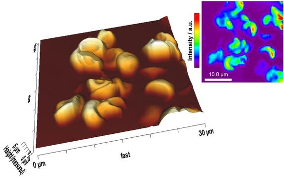 A cluster of red blood cells found in Ötzi the Iceman's mummy.