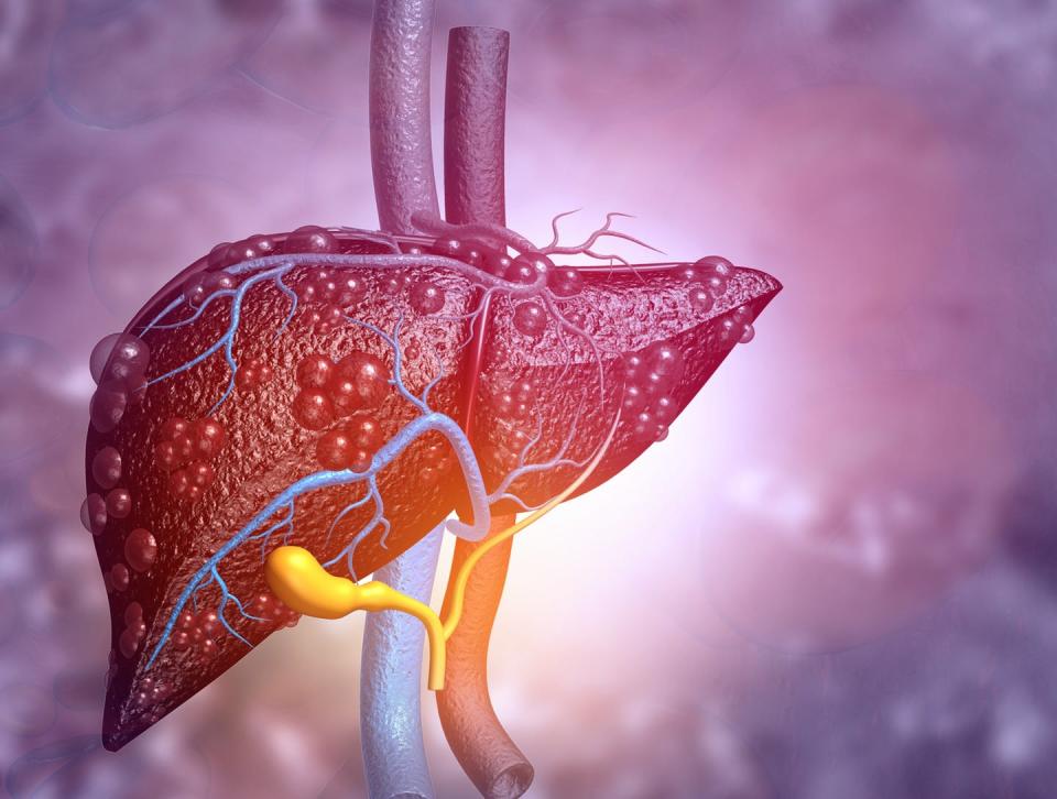 <span class="caption">It may be homely, but your liver is extremely helpful. You can’t live without it.</span> <span class="attribution"><a class="link " href="https://www.shutterstock.com/image-illustration/3d-illustration-abstract-medical-background-diseased-1118711141" rel="nofollow noopener" target="_blank" data-ylk="slk:Explode/Shutterstock.com;elm:context_link;itc:0;sec:content-canvas">Explode/Shutterstock.com</a></span>