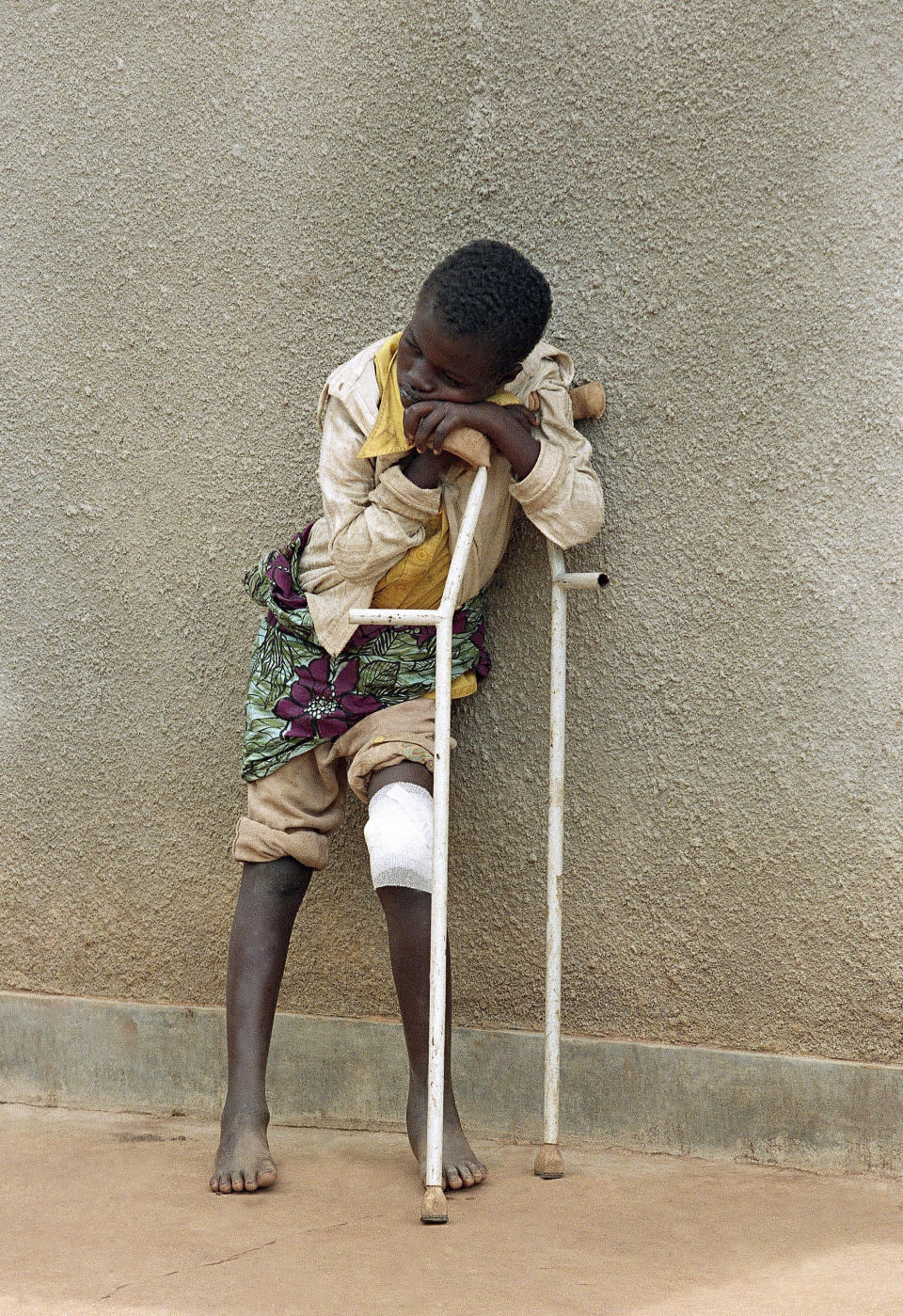 FILE - A boy who survived a massacre in the village of Karubamba in April and whose leg was wounded by a machete, rests on his crutches at a hospital near Gahini, in Rwanda, May 13, 1994. The massacres, mostly by gangs wielding machetes, swept across Rwanda and groups of people were killed in their homes and farms and where they sought shelter in churches and schools. (AP Photo/Jean-Marc Bouju, File)