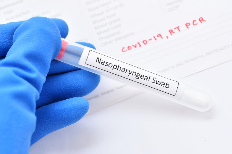 Since the coronavirus is an RNA virus, a sample swab, either a nasopharyngeal or oropharyngeal, must be sent to a laboratory to go through several steps to convert the RNA into viral DNA (Reverse Transcription)