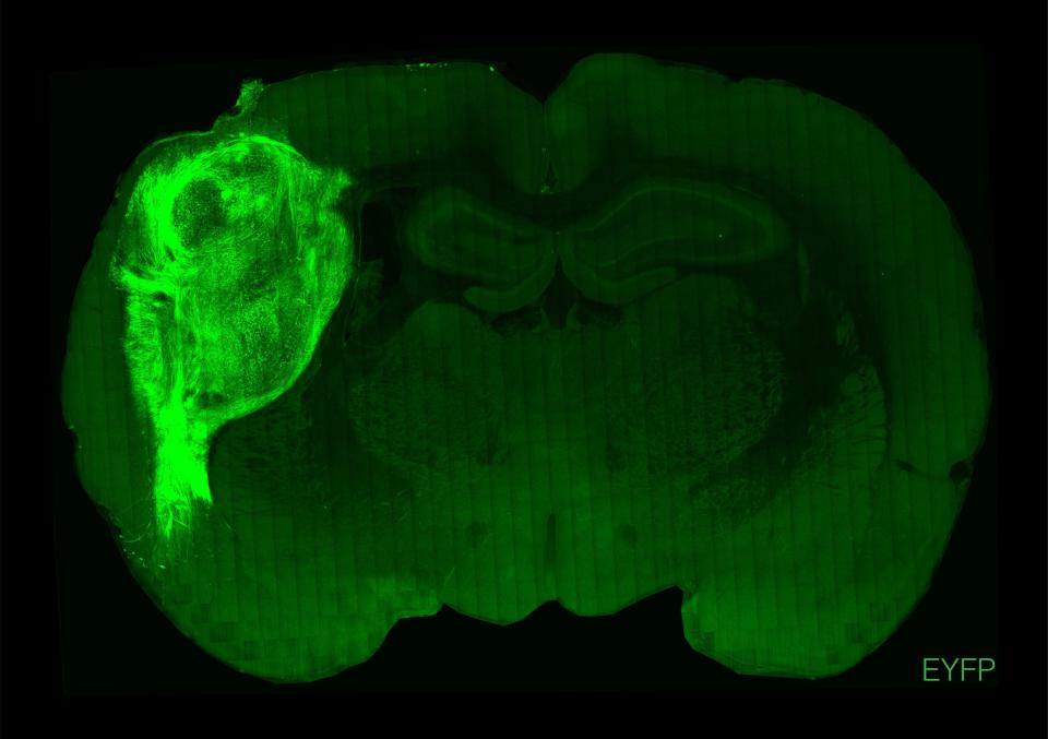 Transplanted human cells in the brain of a rat.