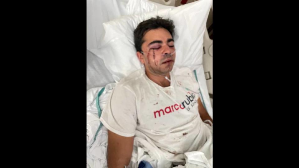 Un hombre con una camiseta de la campaña de Marco Rubio fue atacado el domingo 23 de octubre de 2022 en Hialeah, según el senador federal Marco Rubio.