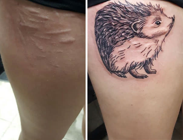 Tatuajes sobre cicatrices