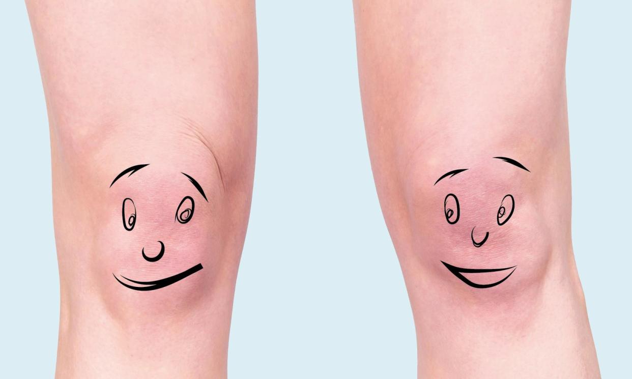 <span>‘Just because knee issues are common, that doesn’t mean we should ignore them and soldier on.’</span><span>Composite: Guardian Design; Itani/Alamy</span>