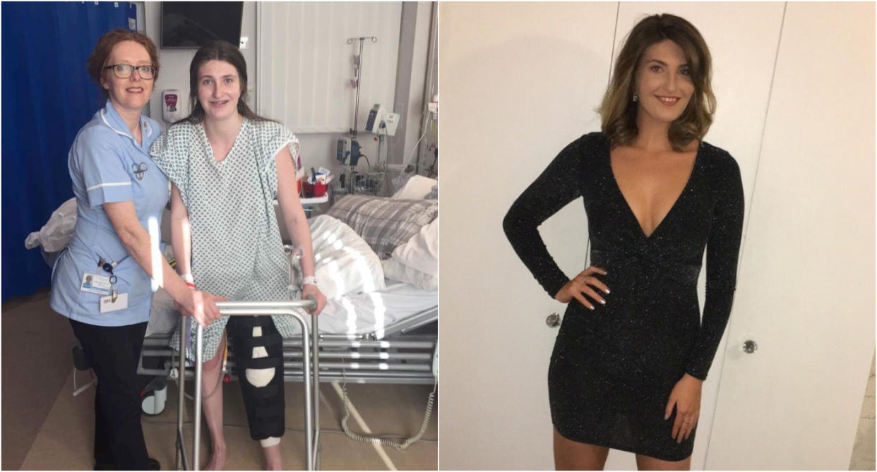 A split image of Bethany Eason who had a Giant Cell Tumour