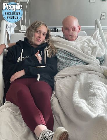 <p>Courtesy James Family</p> Allie James and her dad Aaron in the hospital after he was electrocuted on the job in 2021.