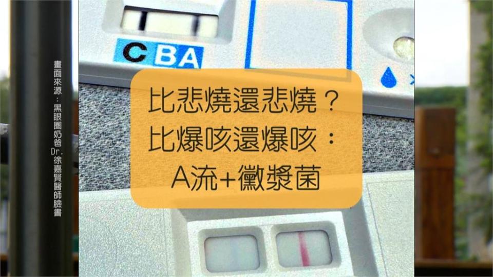 小朋友高燒又狂咳　4條線！同時染上A型流感合併黴漿菌