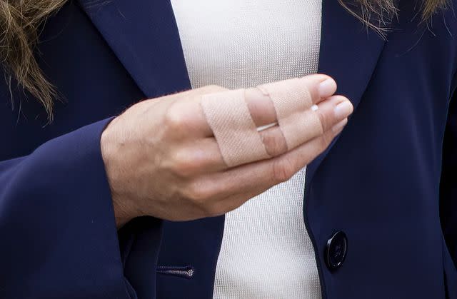 <p>Mark Cuthbert/UK Press via Getty Images</p> A photo of Kate Middleton's bandaged fingers during a visit to HMP High Down on Sept. 12.