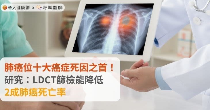 肺癌位十大癌症死因之首！研究：LDCT篩檢能降低2成肺癌死亡率