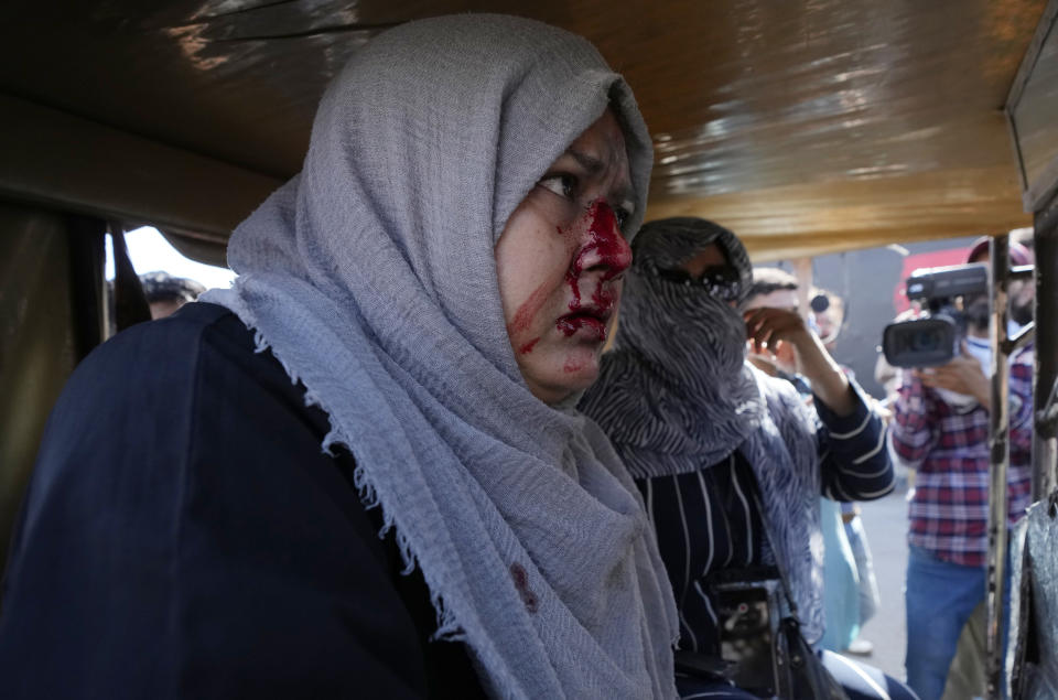 A woman is injured in the clashes between police and supporters of Pakistan's former Prime Minister Imran Khan, in Karachi, Pakistan, Thursday, May 11, 2023. Pakistan's Supreme Court has ordered the release of Khan, two days after his arrest sparked countrywide violence. (AP Photo/Fareed Khan)