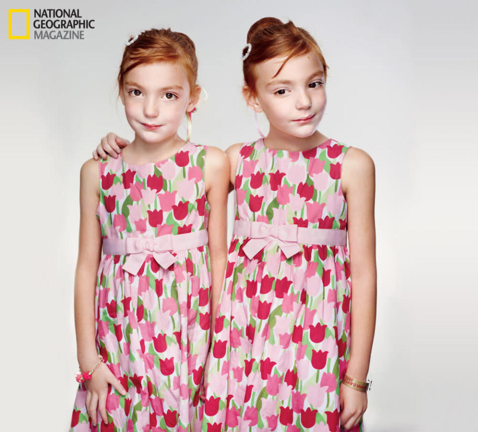 <b>Twins | January 2012 National Geographic magazine</b> <br> Six-year-old twins who both have mild autism, a disorder linked to genetic inheritance. (Photo by Martin Schoeller/National Geographic) <br> <br> <a href="http://photography.nationalgeographic.com/photography/photos/best-ngm-2012" rel="nofollow noopener" target="_blank" data-ylk="slk:Click here to see more images from the "Best of 2012 – National Geographic Magazine Photos of the Year.";elm:context_link;itc:0;sec:content-canvas" class="link ">Click here to see more images from the "Best of 2012 – National Geographic Magazine Photos of the Year."</a>