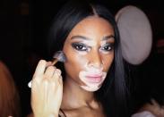 <p>Model Winnie Harlow poses backstage before the Julien Macdonald show during London Fashion Week in September 2017. </p>