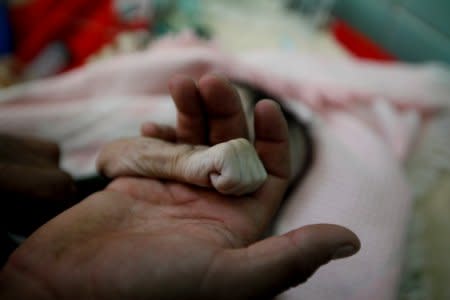 Saleh Hassan al-Faqeh holds the hand of his four-month-old daughter, Hajar, who died at the malnutrition ward of al-Sabeen hospital in Sanaa, Yemen, November 15, 2018.  REUTERS/Mohamed al-Sayaghi
