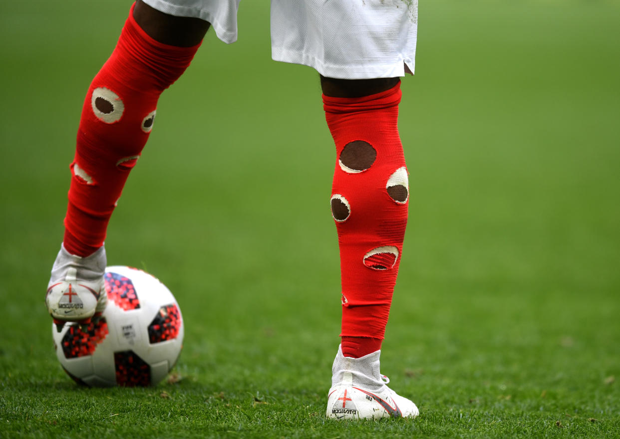 Danny Rose’s socks were attracting attention as England clashed with Belgium