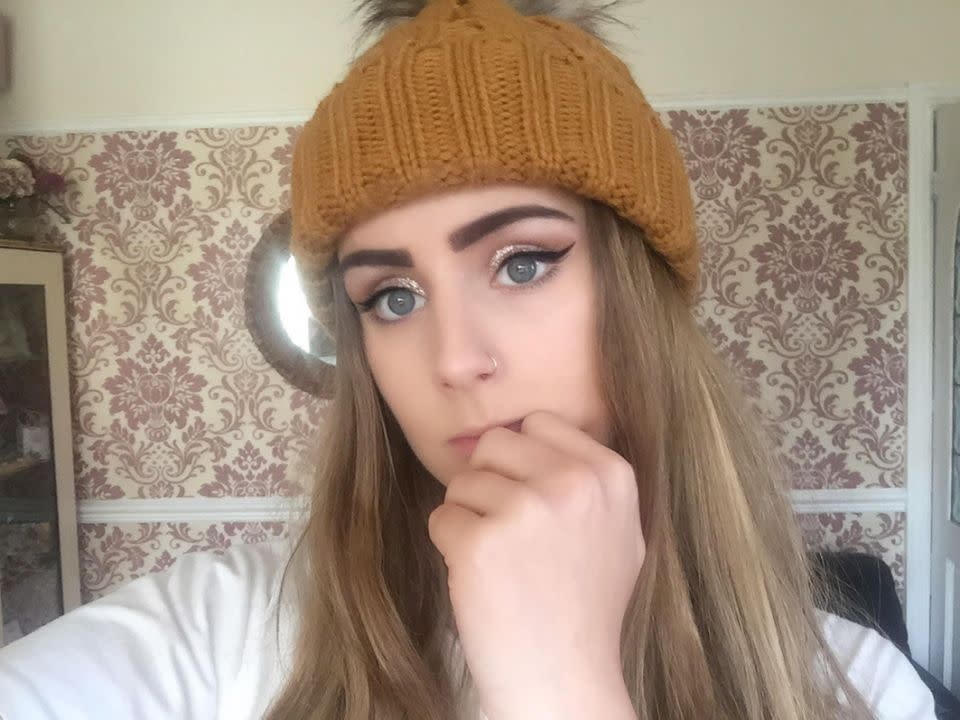 A teenager has revealed shocking pictures after an eyebrow tint stuck to her brows 