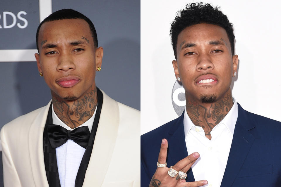 A before-and-after look at Tyga’s hairline. (Photo: Getty Images)