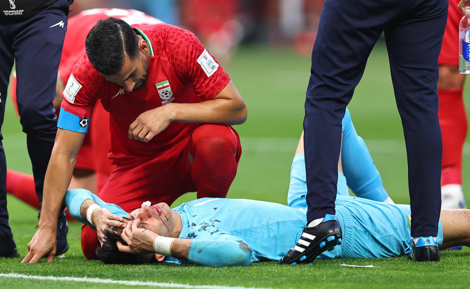 Alireza Beiranvand, pictured here the ground after a head clash against England at the World Cup.