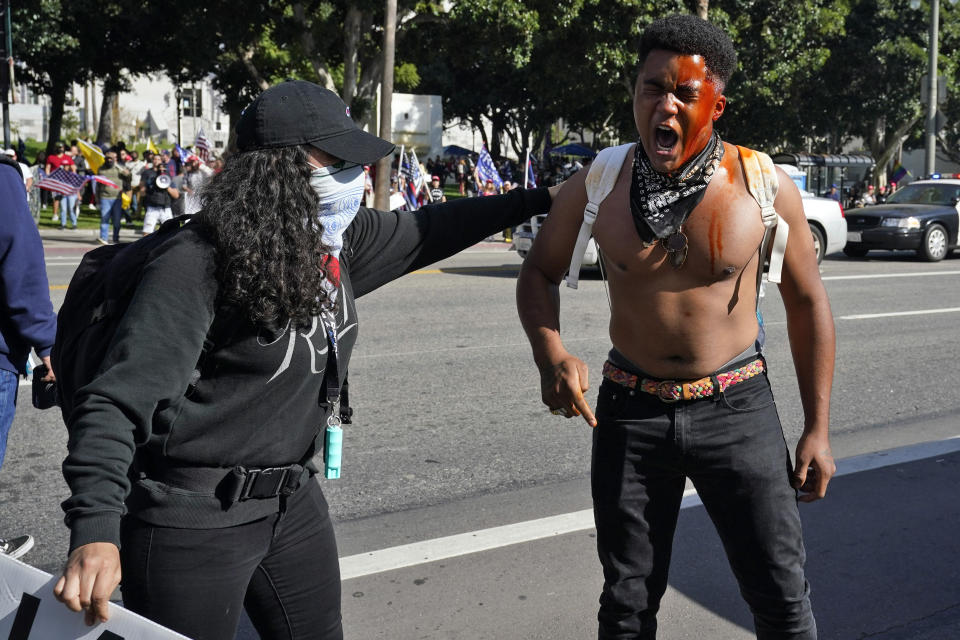 A counterdemonstrator yells after getting maced in the face by far-right demonstrators outside of City Hall on Wednesday in Los Angeles. (AP Photo/Marcio Jose Sanchez)