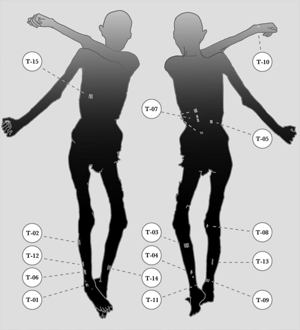 Careful analysis of Ötzi's remains show that he had at least 61 tattoos around his body. Not all of them were evident at first.