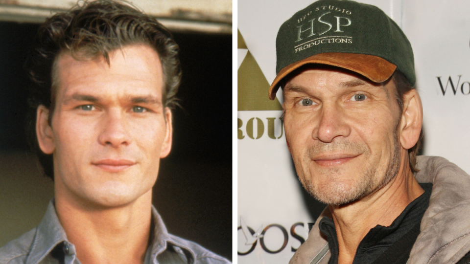 Patrick Swayze Left: 1983; Right 2008