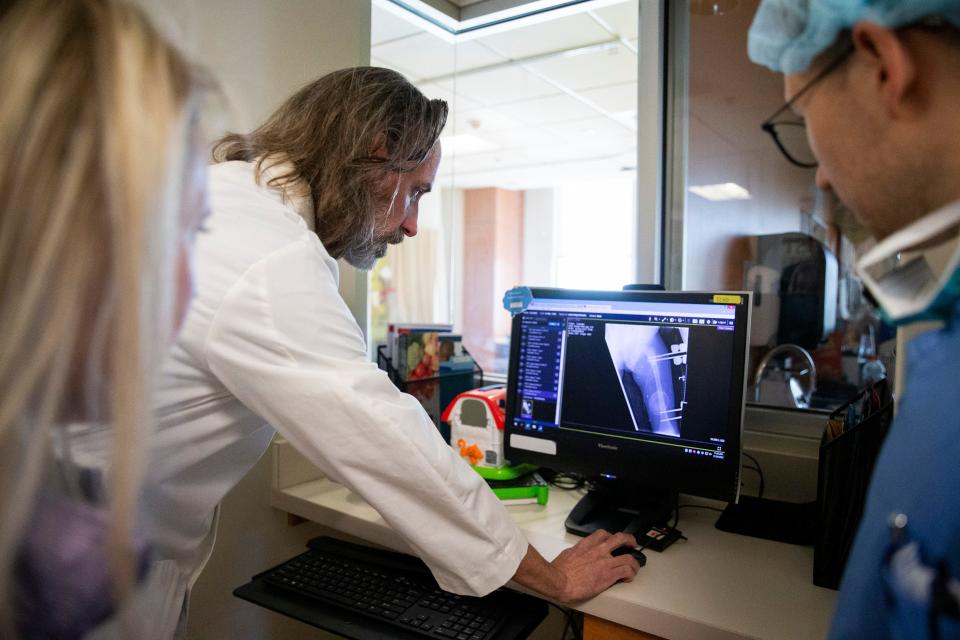 Dr. Derek Kelly, an orthopedic surgeon at Le Bonheur Children’s Hospital and Campbell Clinic, looks at an X-ray of Chance Futrell’s left leg with Lindsey Locke, a nurse practitioner, and Elliot Konrade, a third-year orthopedic surgery resident, at the hospital in Memphis, Tenn., on Wednesday, November 29, 2023. Futrell was accidentally shot by his friend 14 years ago when he was 10 years old and underwent 18 surgeries.