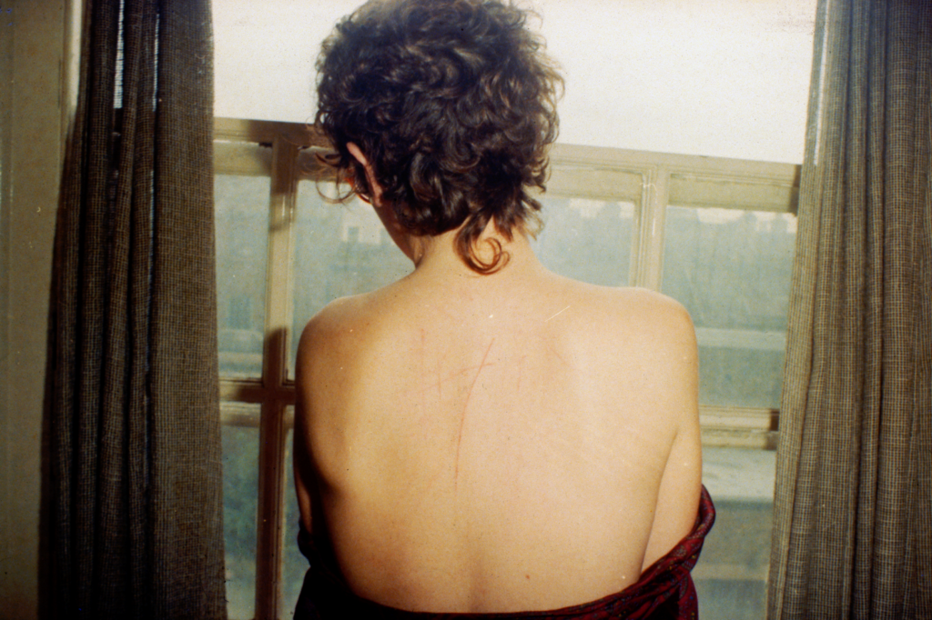 <em>All the Beauty and the Bloodshed</em>: Self portrait with scratched back after sex, London 1978 (Photo courtesy of Nan Goldin)